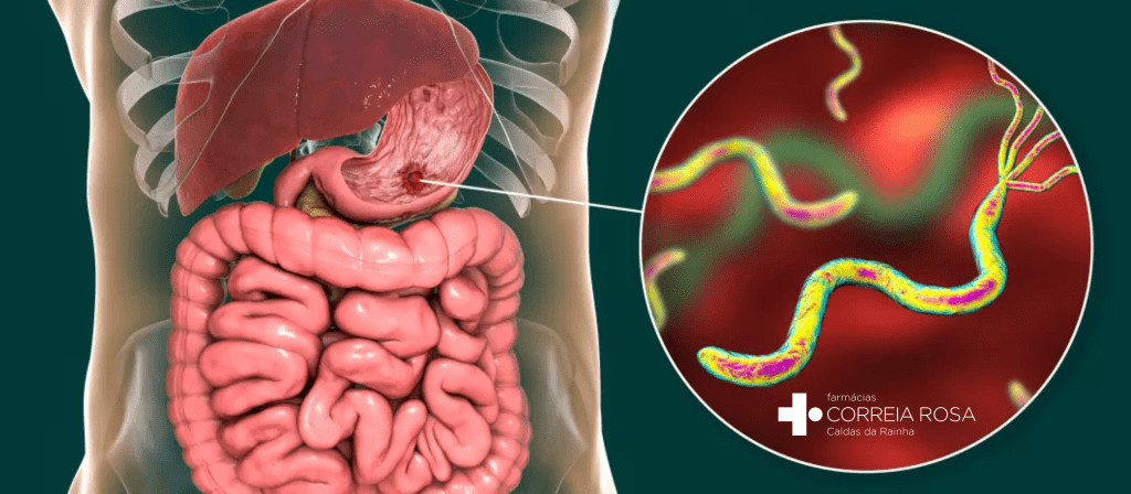 Causas e sintomas bactéria H.pylori Farmácias Correia Rosa Caldas da Rainha