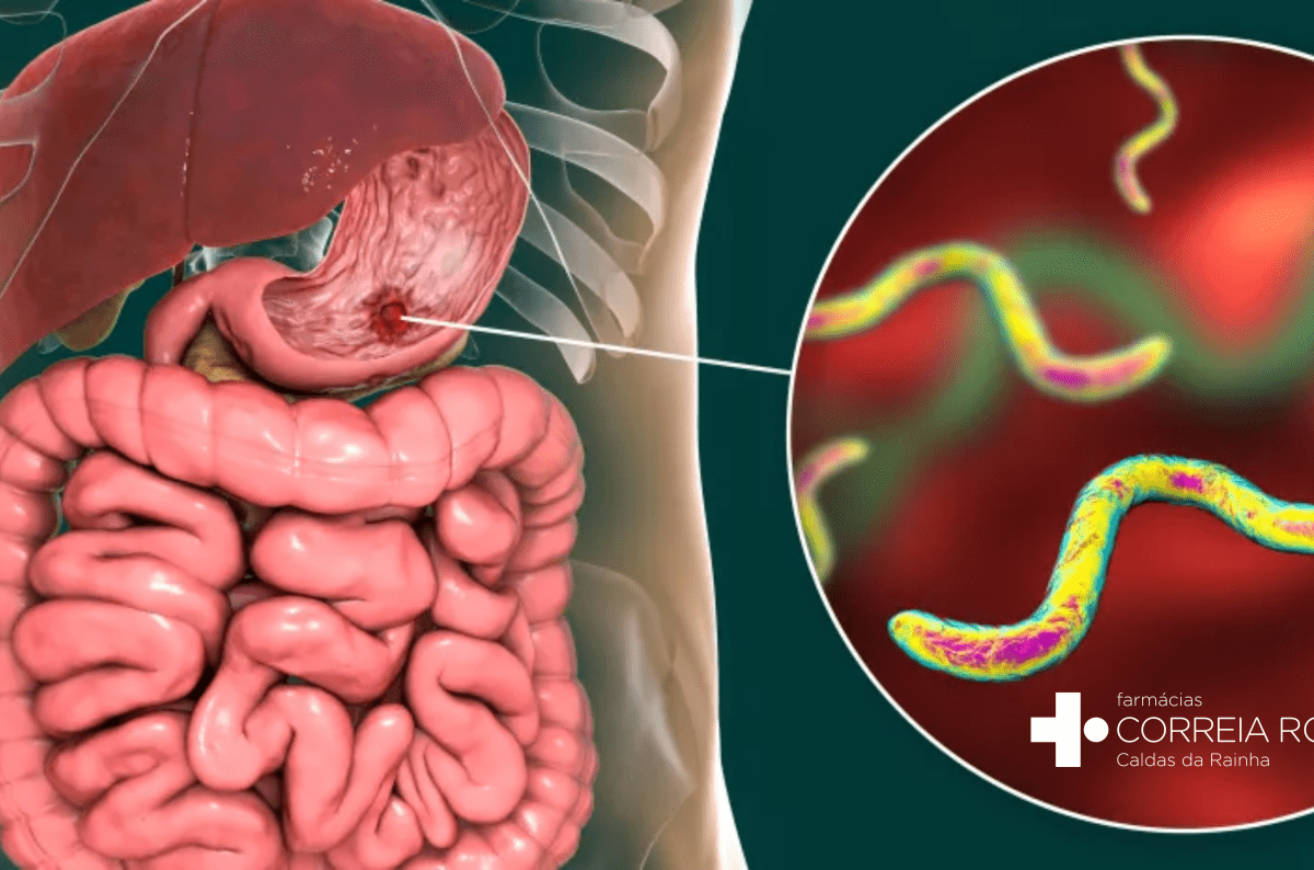 H.pylori: sintomas, causas e diagnóstico 