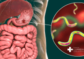 Teste de Despiste de Bactéria H.Pylori