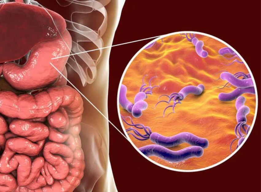 O que é o H.pylori Farmácias Correia Rosa Caldas da Rainha
